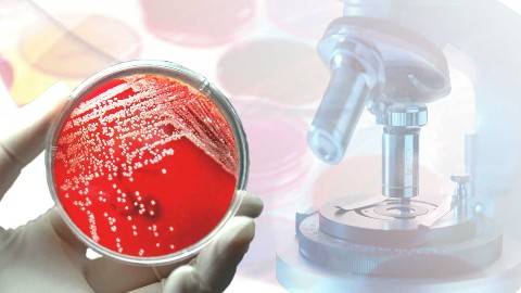 《微生物检验技术》PPT课件 胡生梅 襄阳职业技术学院