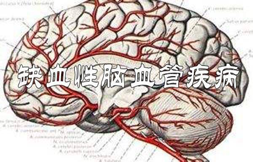 缺血性脑血管疾病